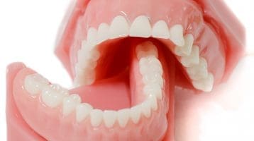 dentures in Yuma AZ